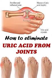 Pin On Uric Acids
