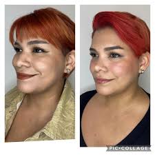 Otorrino en Hermosillo