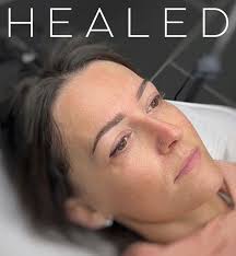 💖 This is for the course I am attending next week! Please message myself  or Claire Raymond PMU to be considered 💖 Edited to add... must be under  40,