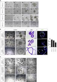 Ovaries are the female reproductive organs that produce eggs. Developing Organoids From Ovarian Cancer As Experimental And Preclinical Models Sciencedirect