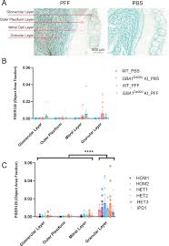 Neither alpha-synuclein-preformed fibrils derived from patients with GBA1  mutations nor the host murine genotype significantly influence seeding  efficacy in the mouse olfactory bulb