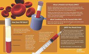 Many insurance plans, as well as medicare and medicaid do cover prep, though you should check with your specific plan to be sure. Integrative Health Wellness In Lewiston Platelet Rich Plasma Prp In Lewiston Integrative Health Wellness