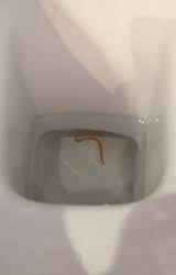 And not just what's lurking in the bowl, but also under the rim and in the jets holes. Worm In Toilet Is A Bloodworm All About Worms
