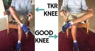 After a knee replacement, it can be tempting to take it easy on the exercise front for a while. Can You Sit Cross Legged After Knee Replacement My Attempt
