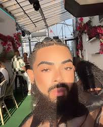 Say Goodbye to Excessive Sweating with Botox Treatments