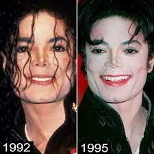 When michael jackson passed away in 2009, his death left behind many unanswered questions about the eccentric pop star's alleged plastic surgery.throughout his career, his dramatic. Michael Jackson S Plastic Surgery See His Transformation