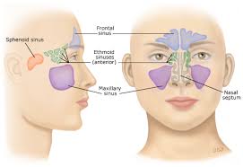 Image result for Sinusitis Prediction Rule