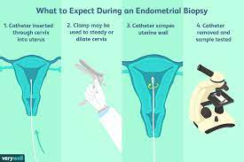 Natural Killer Cells And Infertility What To Know