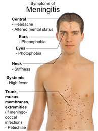 Infections Of The Spine Such As Meningitis And Discitis Spine Health