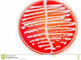 contagem das bacterias na cultura da urina imagem de stock imagem de vermelho petri 74599965