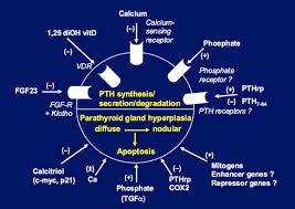 Image result for Hyperparathyroidism