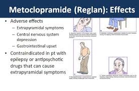 Image result for Extrapyramidal Side Effect