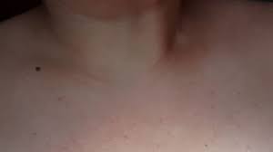 Manchas rojas en la piel de mi bebe. Coronavirus El Estudio Que Muestra Que Las Lesiones En La Piel Pueden Ser Un Sintoma De La Covid 19 Y Cuales Son Las Mas Comunes Bbc News Mundo