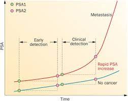 This typically causes benign prostatic. Psa Course Over Time In Men With Prostate Cancer And Bph Screening Can Download Scientific Diagram