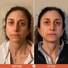 Winners of the Head, Neck & Face Challenge