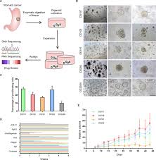 A painful or burning sensation in the abdomen. Human Gastric Cancer Modelling Using Organoids Gut