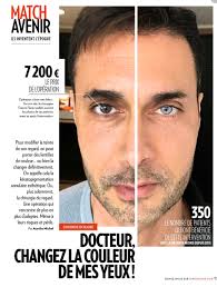 Mais si les yeux sont à l'origine une nuance sombre, alors sans l'utilisation de lentilles de contact colorées ne peut pas faire. Christophe Trivalle On Twitter Si Vous Aviez 7200 Seriez Vous Pret A Vous Faire Operer Pour Changer La Couleur De Vos Yeux