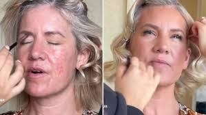 MAFS 2024: Lucinda Light shares raw video about her skin and rosacea  insecurities