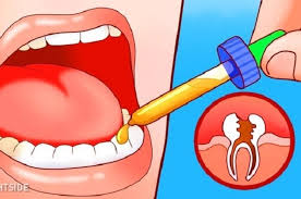 Rasa ngilu ini bisa terjadi saat terpapar pada sesuatu yang panas, dingin, atau asam. Dengan 5 Bahan Alami Ini Sakit Gigi Tak Tertahan Reda Dalam 1 Menit Semua Halaman Intisari