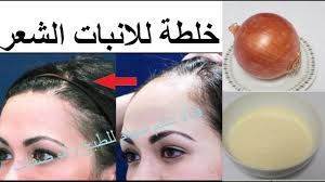 خلطة ناجحة و حل نهائي للانبات الشعر في مقدمة الرأس والتخلص من الفراغات وتساقط الشعر في 7 ايام youtube