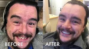 Aaron Wallender, MD, DDS-The Studer Family Children's Hospital at Sacred  Heart