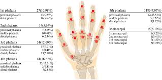 Image result for Hand Growth Plates