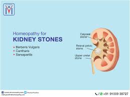 Homeopathy For Kidneystones Berberis Vulgaris Cantharis And Sarsaparilla Homeopathy Homeopathy Treatment Natural Health