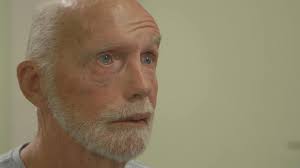 Efter operation: Jørgen blev lam i ansigtet