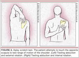 Image result for Shoulder Exam
