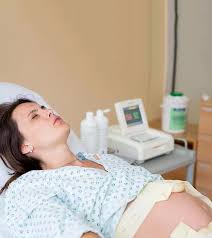 Membrane Sweep: Expert Guide To Labor Induction, Risks & Timing