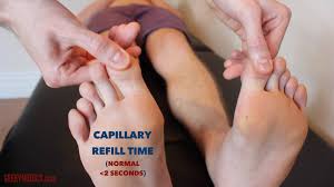 The capillary nail refill test is a quick test done on the nail beds. Peripheral Vascular Examination Osce Guide Geeky Medics