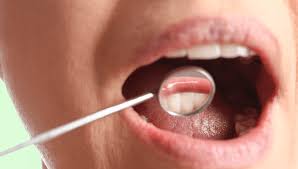 Image result for brown tongue symptoms