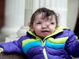 What does it mean when a baby smiles at you? 3d Printer Has Helped 2 Year Child To Smile For The First Time