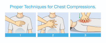 Bls/Cpr_Basic Life Support Bls Training 2022. Questions And Correct Answers  | Bls Cpr, Basic Life Support, Medical Technician