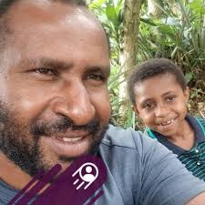 What is the photo of an embryo after miscarriage or abortion?