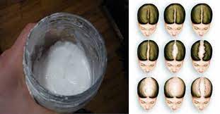 Il bicarbonato è utile in caso di capelli sfibrati e fragili. Come Far Ricrescere I Capelli In 2 Settimane Con Il Bicarbonato Di Sodio Rimedio Naturale