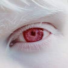 Pin By Yun Chiang On Ch Xerxes Break Albinism Pale Skin Beautiful Eyes