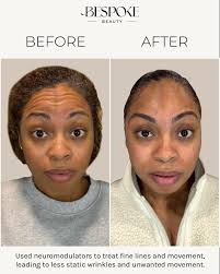 Hannah Light (@hannah.nurseinjectionist) • Instagram photos and videos