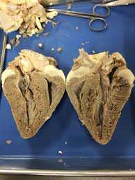 Anterior And Posterior Coronal Section Of Sheep Heart From My Lab Dissection Nmm Dissection Endocrine Human Body