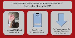 Image result for Tic Management