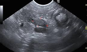 It tends to be discovered at. Canine Insulinoma Clinician S Brief