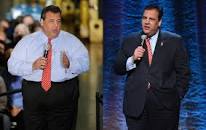 Still Not Skinny, Christie Cheered as a Weight-Loss Surgery ...