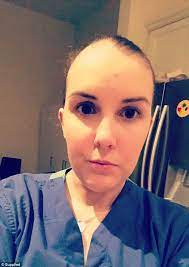 Pin On Alopecia