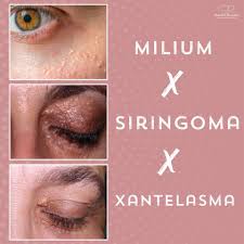 Image result for xantelasma