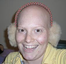 London woman is diagnosed with cancer for the FOURTH time