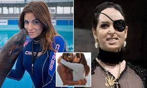Gessica racconta di come la sua storia d'amore si trasforma in una totale manipolazione fino a sfociare nella più vigliacca delle violenze. Ex Boyfriend Who Disfigured Italian Beauty Queen In Acid Attack Has His Jail Term Reduced On Appeal Daily Mail Online