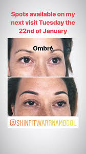 Amy Fenton-Cosmetic Tattooing