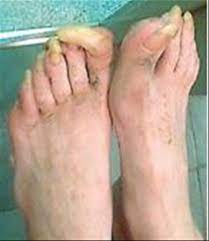 Maybe you would like to learn more about one of these? Unas Largas De Los Pies Un Dibujo Bonito