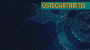 In 1974 dr paul lam, a family physician from sydney australia, took up tai chi to control his arthritis. Treatment Of Osteoarthritis With Complementary And Alternative Medicine The Arthritis Connection