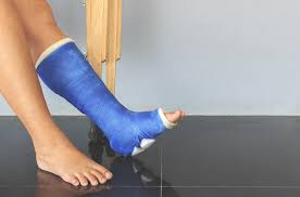 Penyebab telapak kaki gatal adalah kulit kering, reaksi alergi, kutu air, hingga keluhan medis serius lainnya. Ciri Ciri Patah Kaki Yang Harus Anda Perhatikan Hello Sehat
